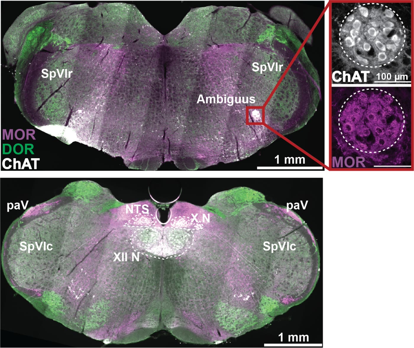 Immunofluorescence image of opioid receptor and ChAT expression in brainstem sections